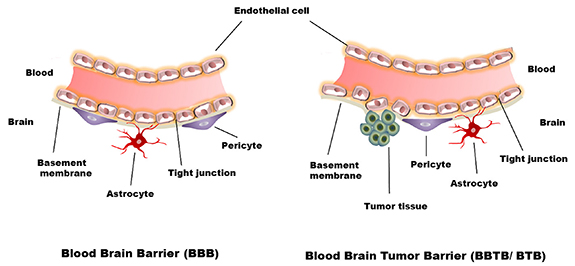 Recent advancements and theranostics strategies in glioblastoma therapy ...