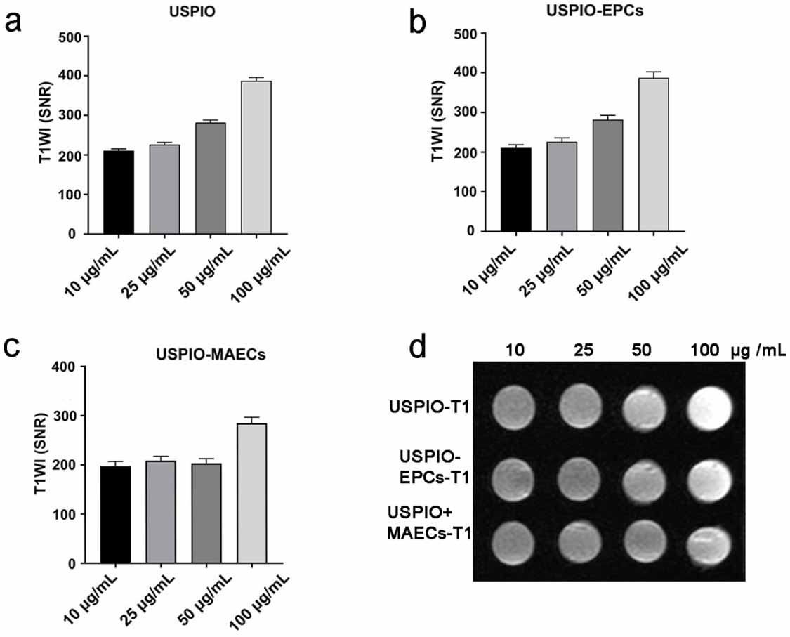 Uspio T1-weighted MRI of targeting atherosclerotic plaque based on CD40 ...