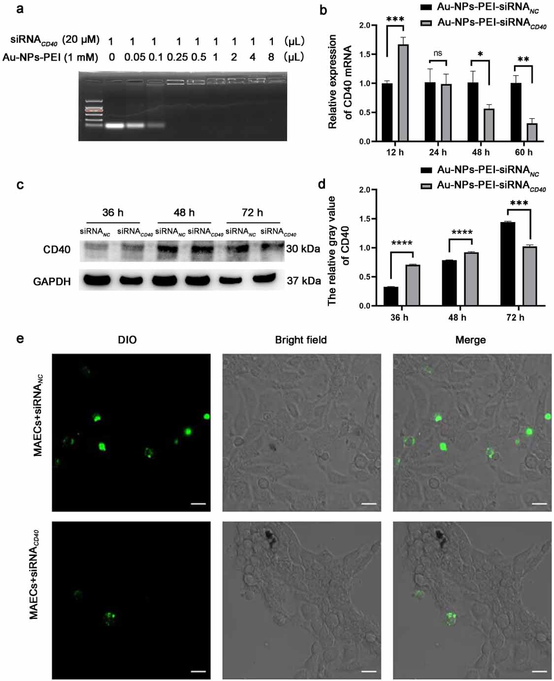 T1-weighted MRI of targeting atherosclerotic plaque based on CD40 ...