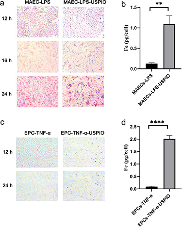 Uspio T1-weighted MRI of targeting atherosclerotic plaque based on CD40 ...