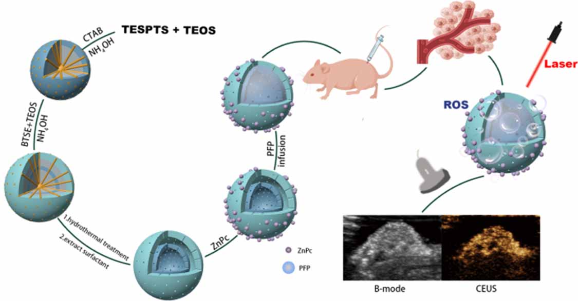 Double-layer hollow mesoporous silica nanoparticles for ultrasound ...