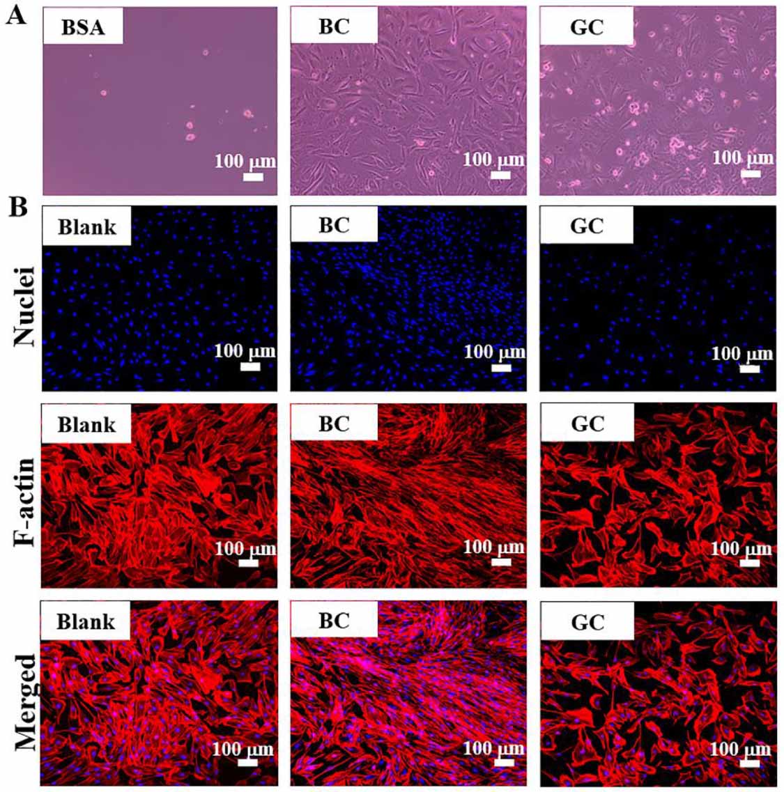 Engineering a durable BDDE cross-linked collagen filler for skin ...