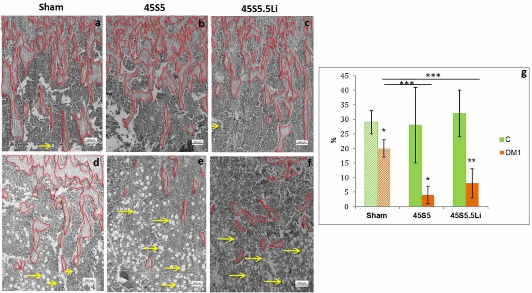 Lithium-containing 45S5 Bioglass-derived glass-ceramics have ...