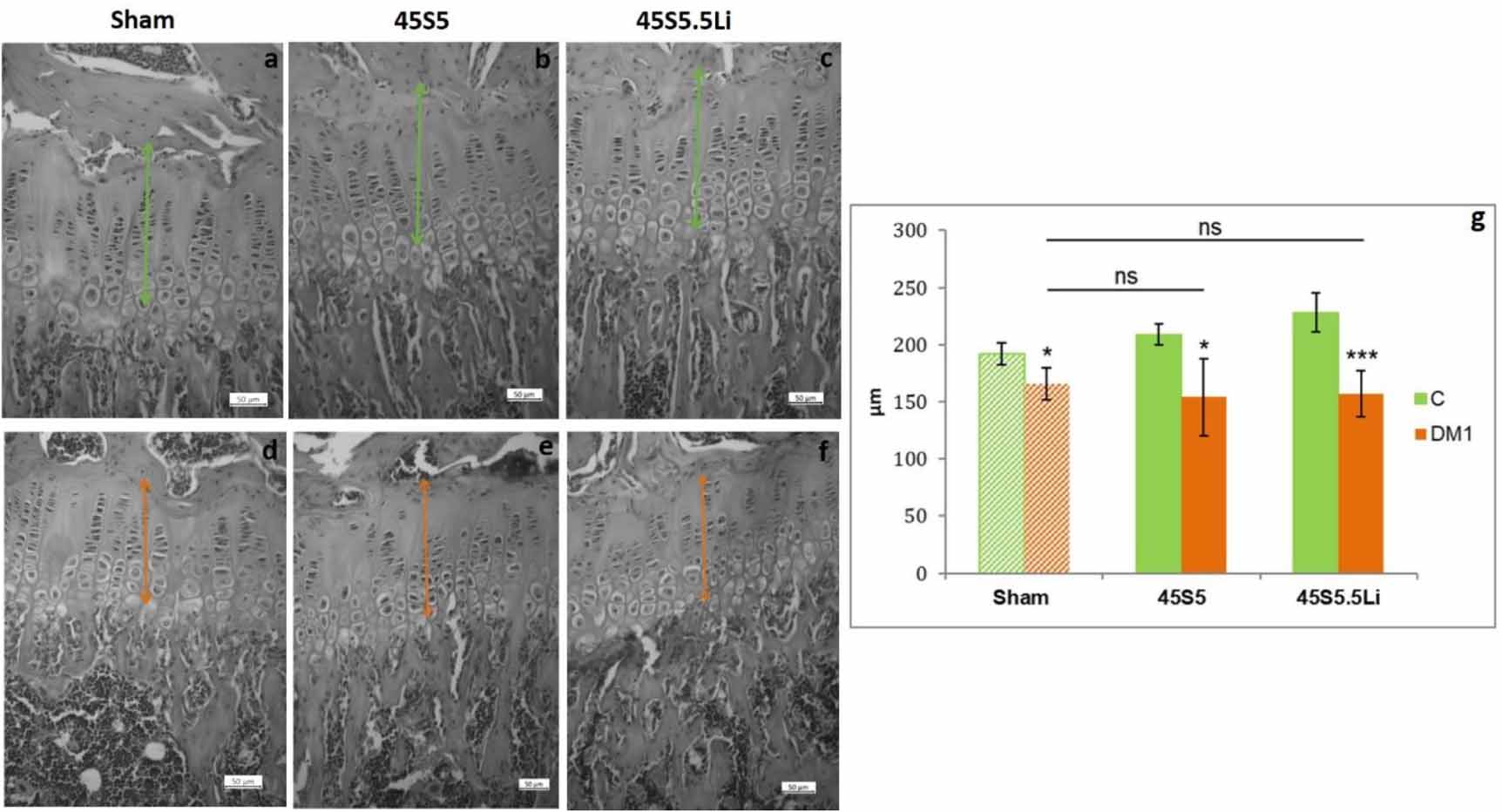Lithium-containing 45S5 Bioglass-derived glass-ceramics have ...