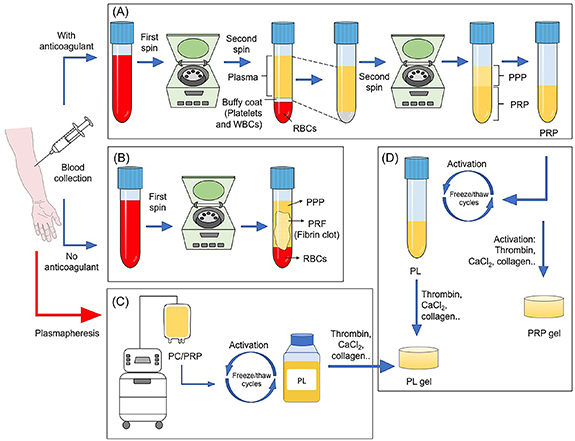 Current trends in the design and fabrication of PRP-based scaffolds for ...