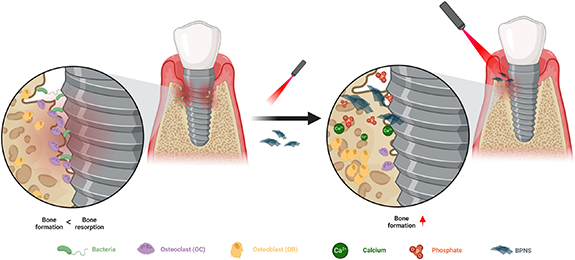 Prospects of black phosphorus nanosheets in the treatment of peri ...
