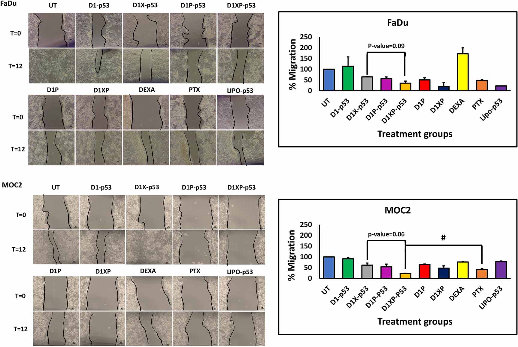 Glucocorticoid receptor-mediated delivery of paclitaxel and anticancer ...