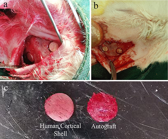De Novo periosteum formation and remodeling activity in human cortical ...