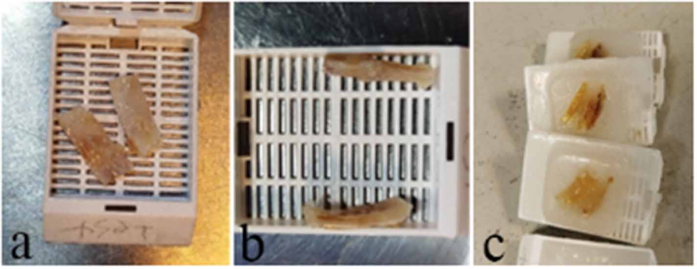 De Novo periosteum formation and remodeling activity in human cortical ...
