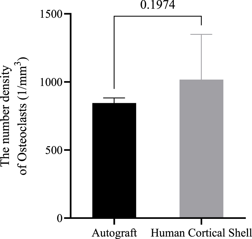 De Novo periosteum formation and remodeling activity in human cortical ...