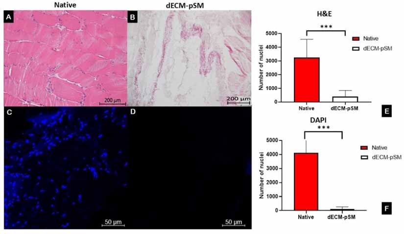 Decellularized matrix of porcine skeletal muscle (dECM-pSM) and its in ...