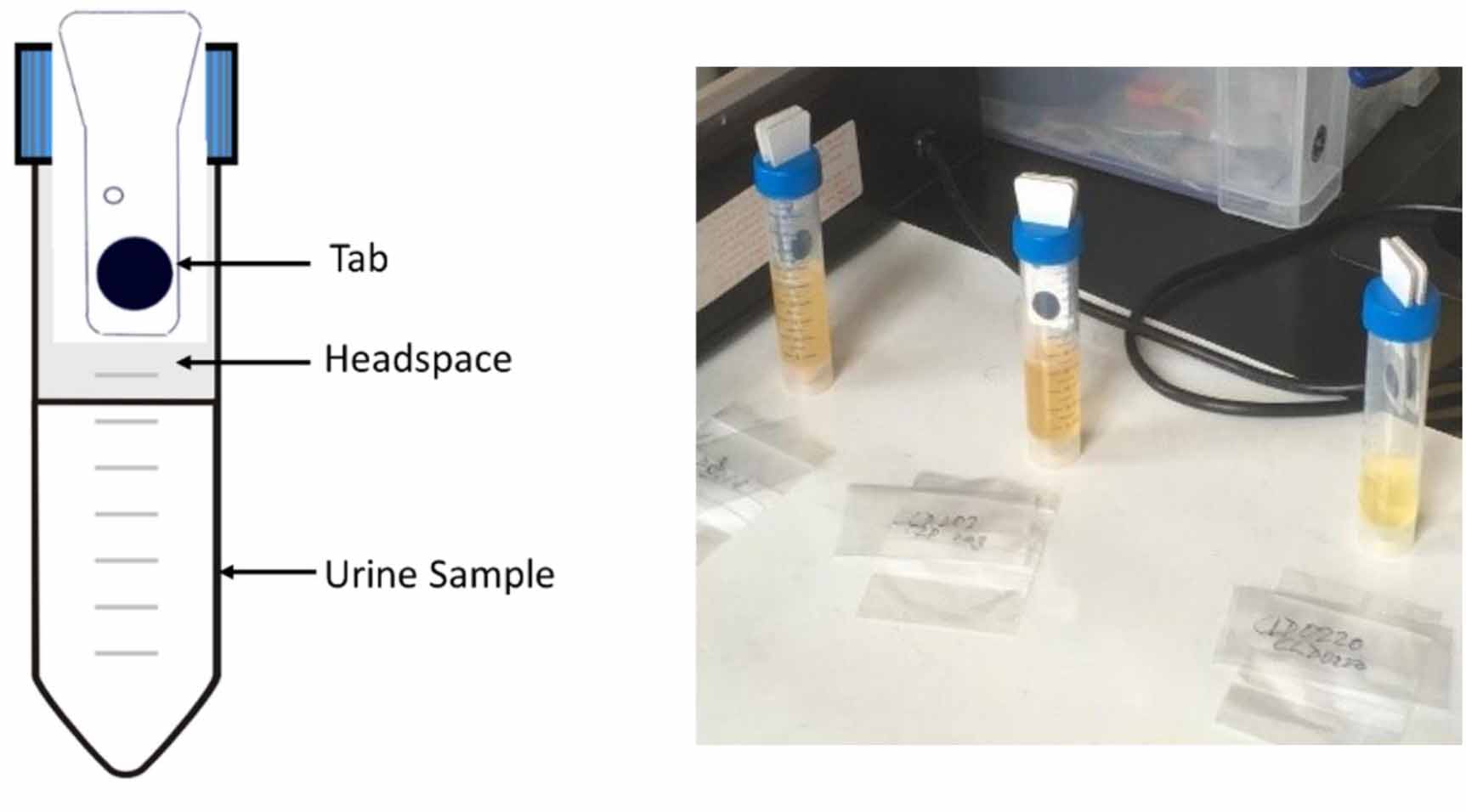Differentiating cancer types using a urine test for volatile organic ...