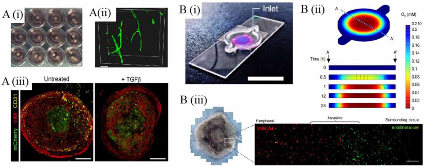 Bioprinting of in vitro tumor models for personalized cancer treatment ...