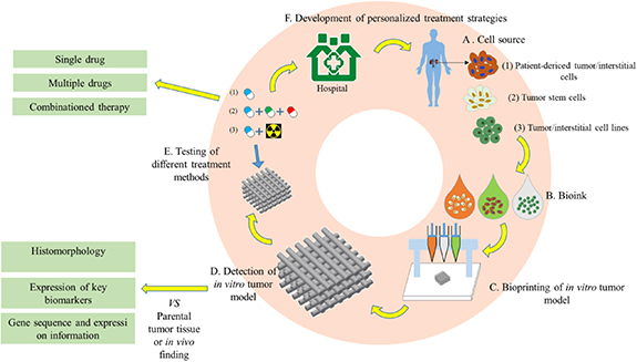 Bioprinting of in vitro tumor models for personalized cancer treatment ...
