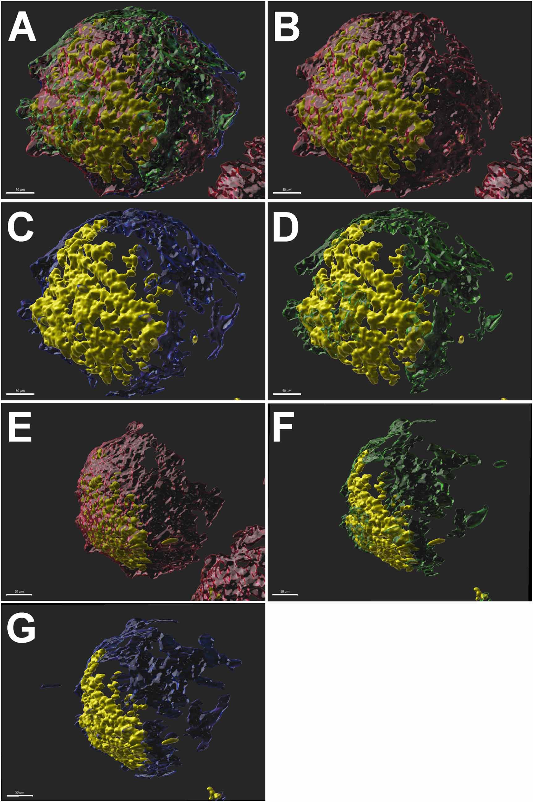 Biofabrication of advanced in vitro 3D models to study ischaemic and ...