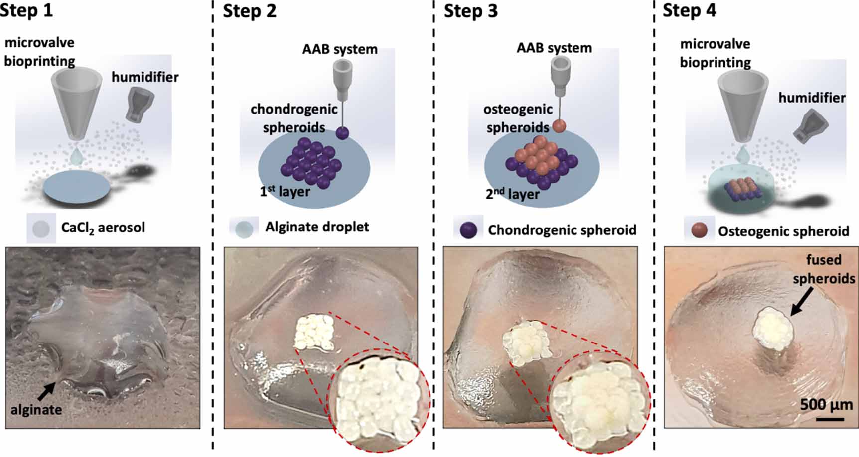 miRNA induced 3D bioprinted-heterotypic osteochondral interface ...