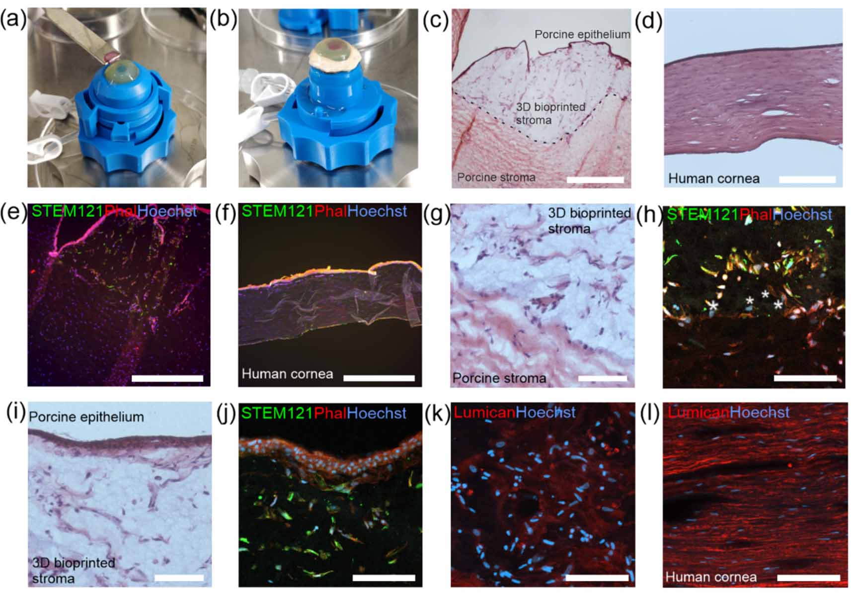 Hyaluronic acid based next generation bioink for 3D bioprinting of ...