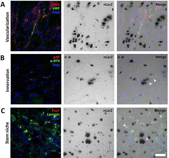 A novel extrusion-based 3D bioprinting system for skeletal muscle ...