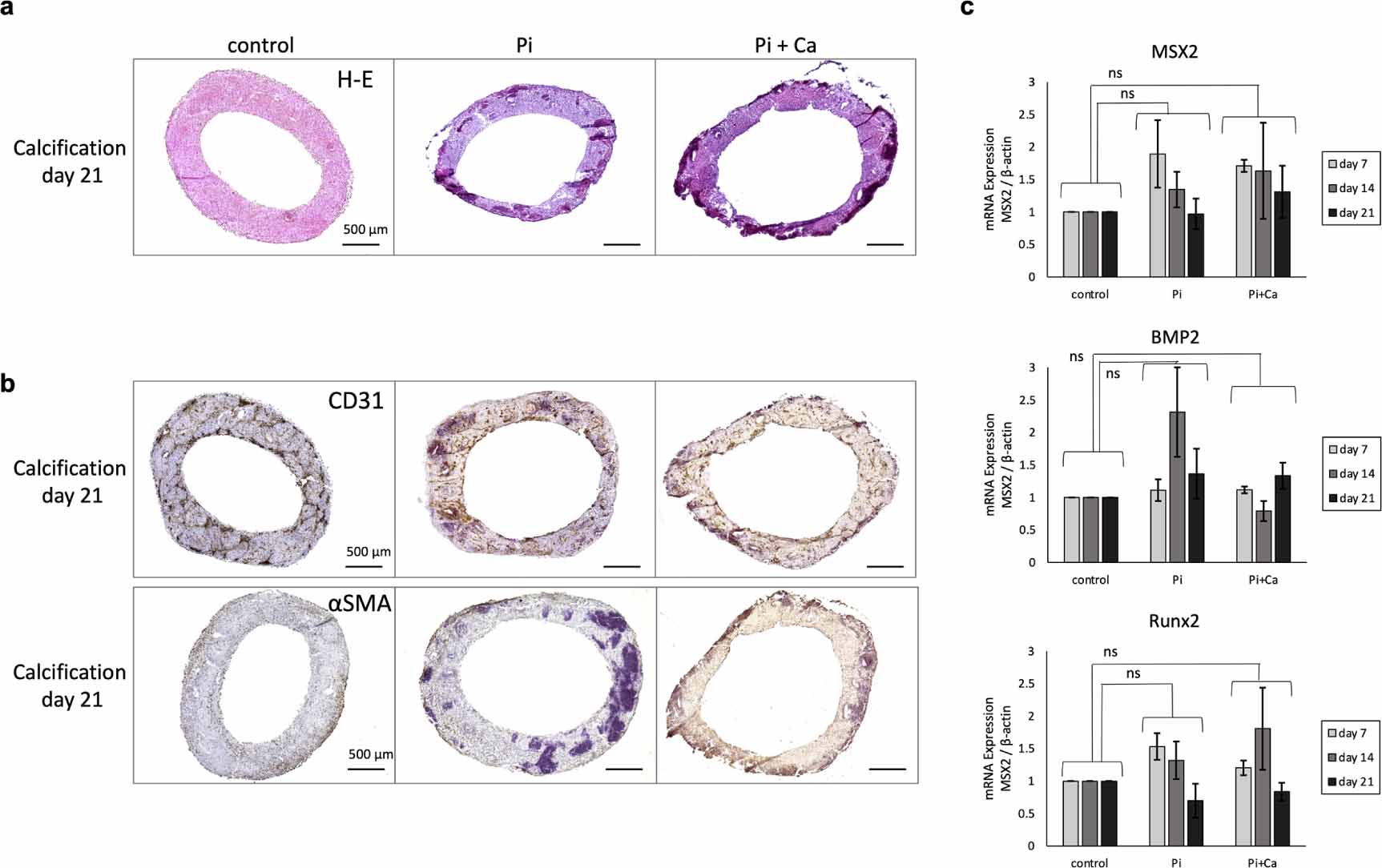Bio Three Scaffold-free human vascular calcification model using a bio-three ...