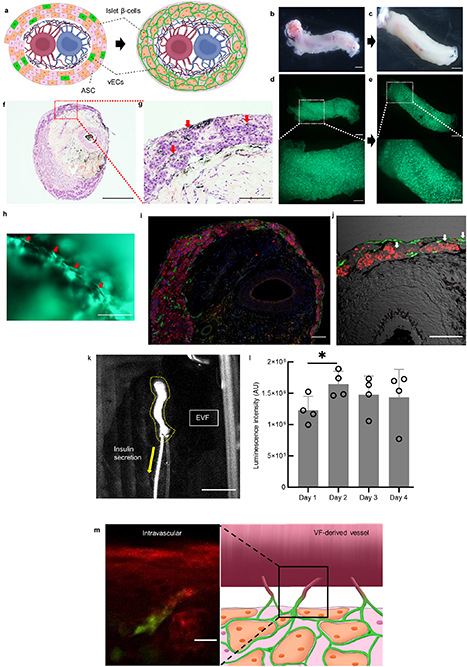 The bioengineering of perfusable endocrine tissue with anastomosable ...