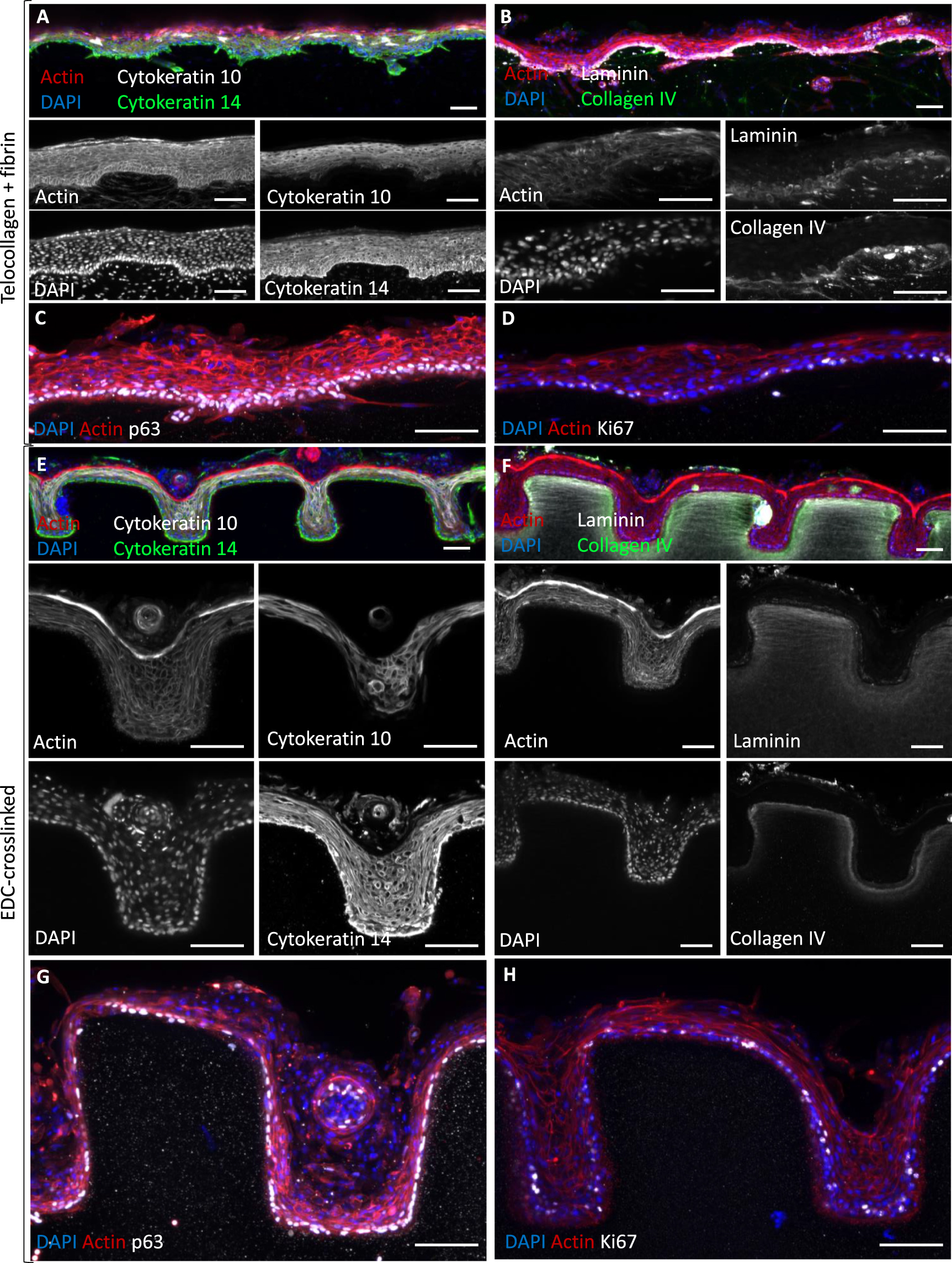 Biomimetic human skin model patterned with rete ridges - IOPscience