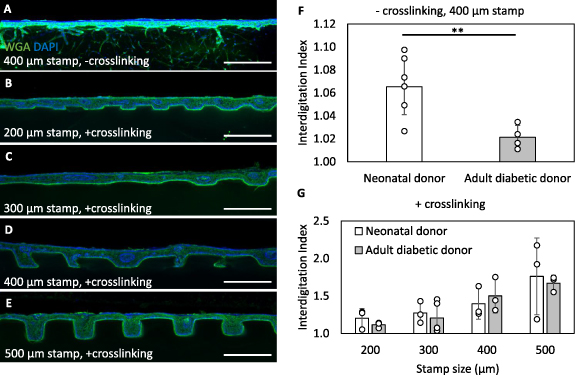 Biomimetic human skin model patterned with rete ridges - IOPscience