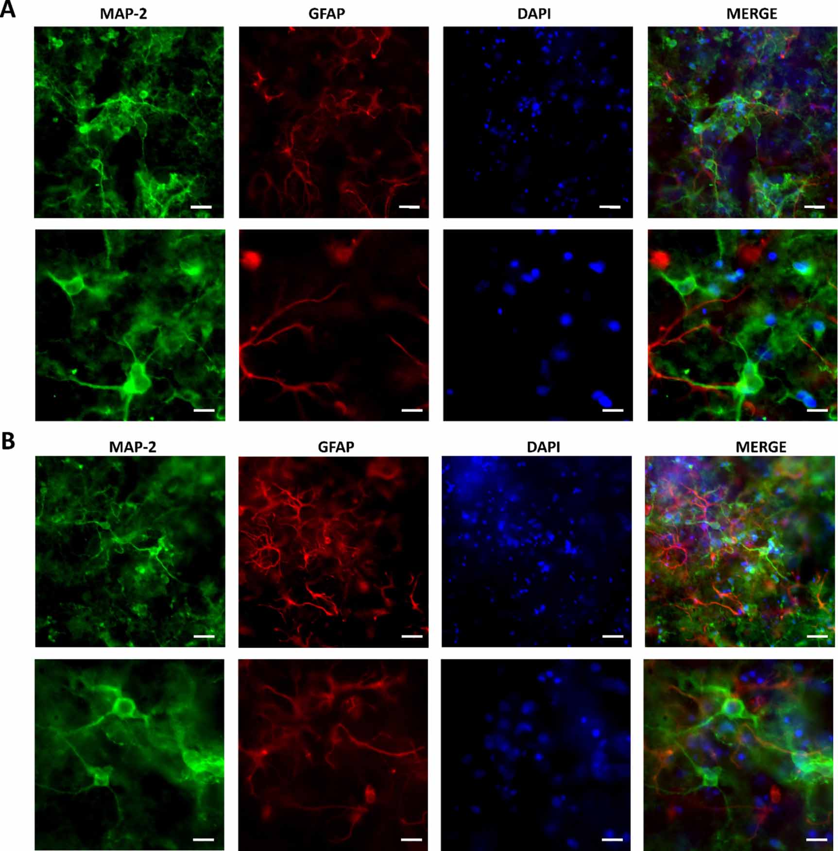 Long-term in vitro culture of 3D brain tissue model based on chitosan ...