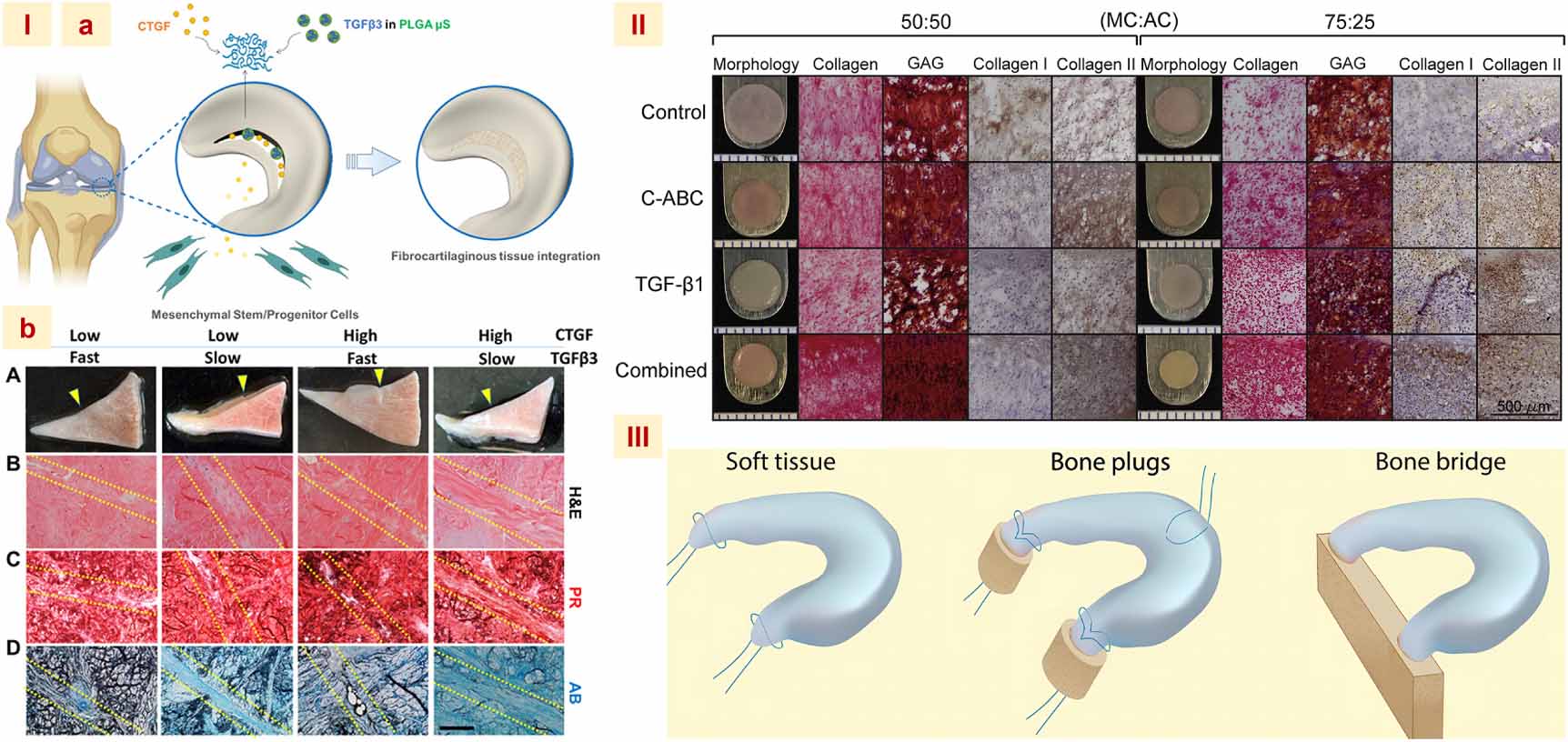 Current advances in engineering meniscal tissues: insights into 3D ...