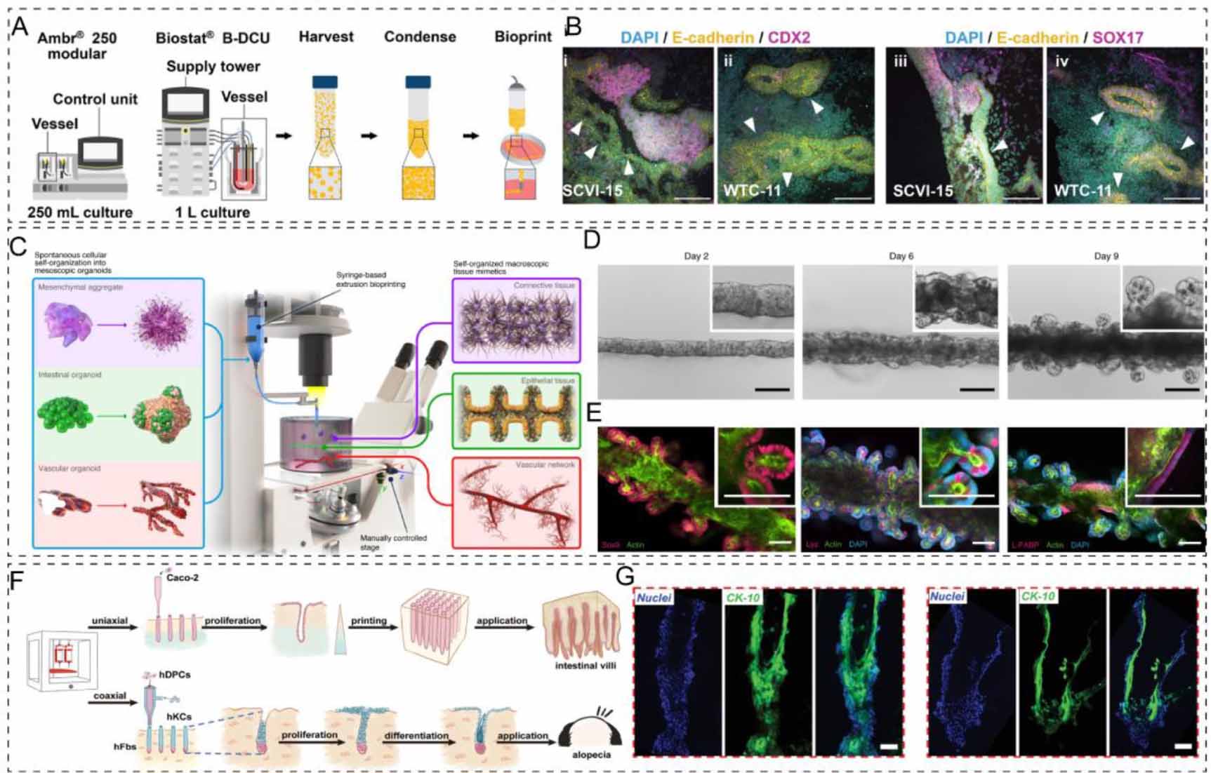 Organoid bioinks: construction and application - IOPscience