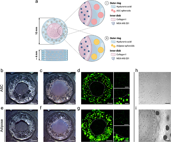 Cancer cell migration depends on adjacent ASC and adipose spheroids in ...