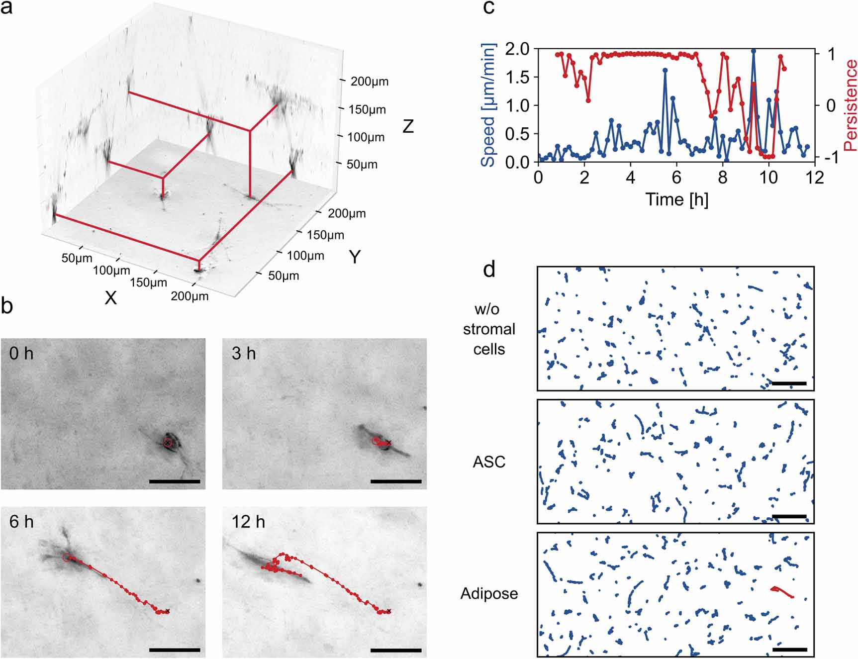 Cancer cell migration depends on adjacent ASC and adipose spheroids in ...