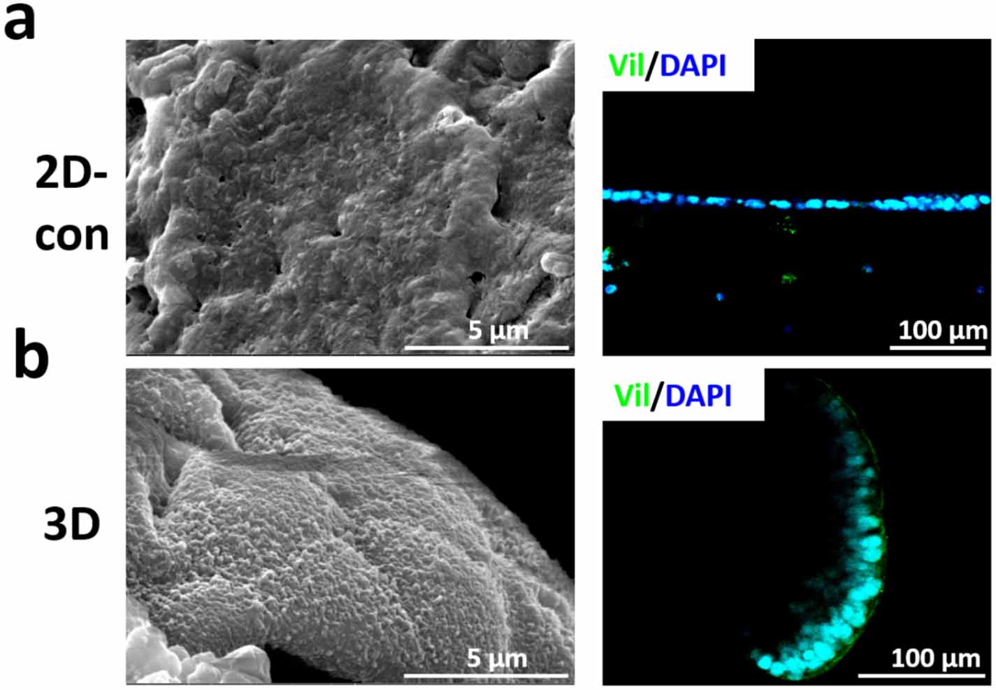 3D embedded bioprinting of large-scale intestine with complex ...