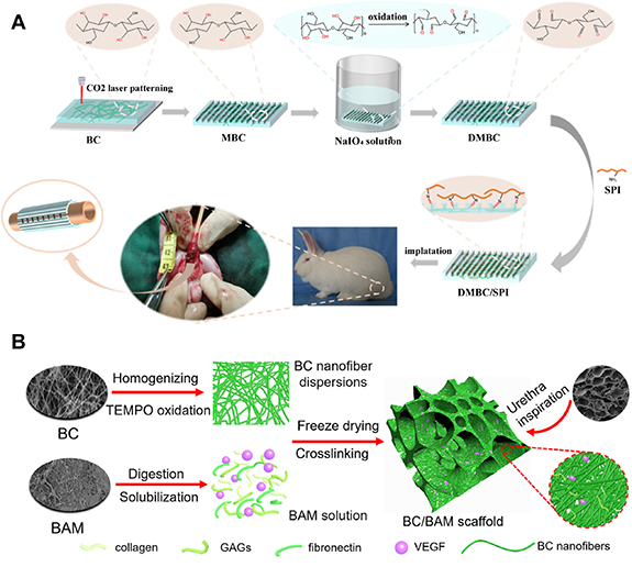Scaffold-based tissue engineering strategies for urethral repair and ...
