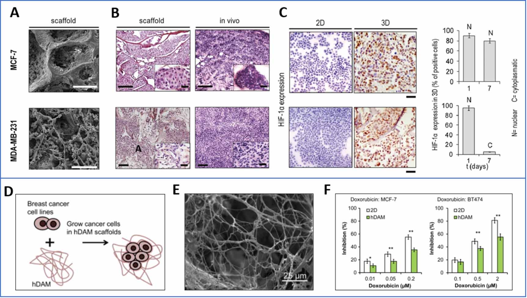 Modeling intratumor heterogeneity in breast cancer - IOPscience