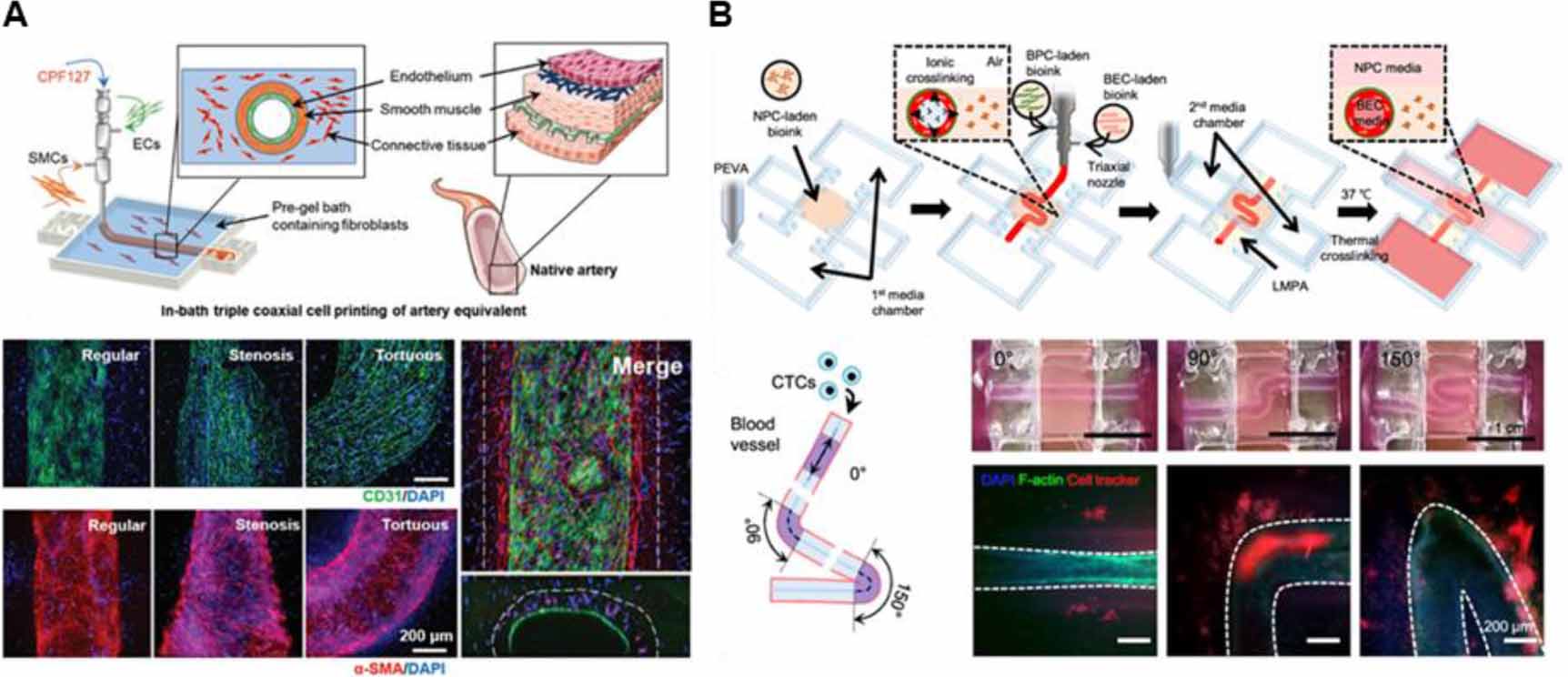 Recent trends in embedded 3D bioprinting of vascularized tissue ...