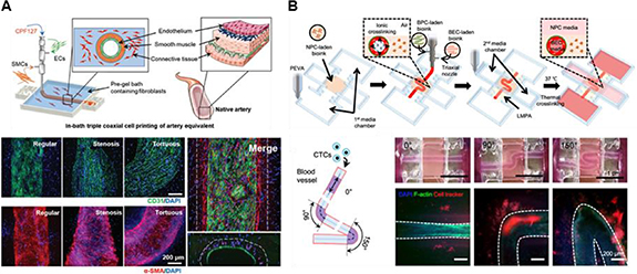 Recent trends in embedded 3D bioprinting of vascularized tissue ...