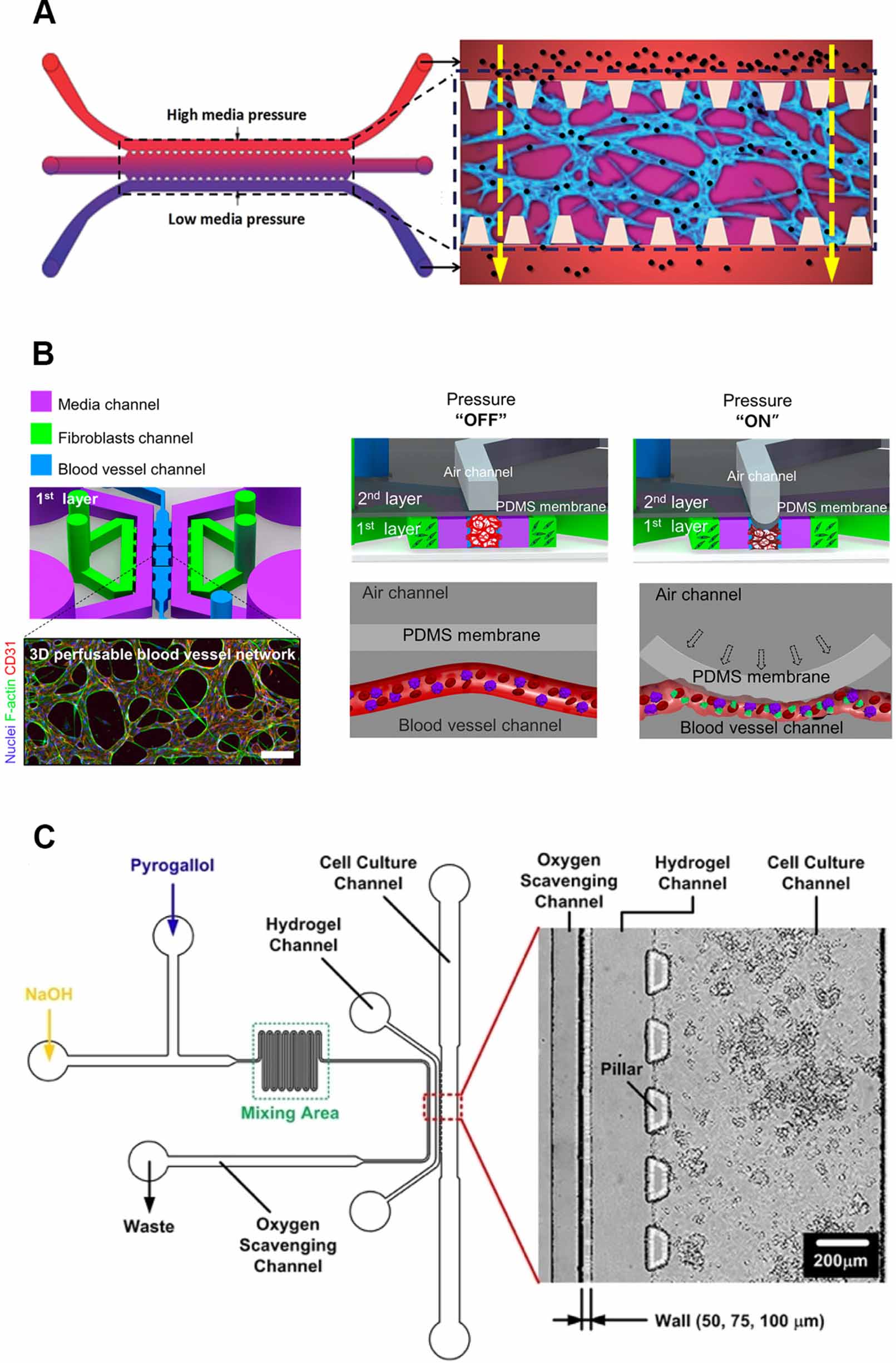 Current progress of in vitro vascular models on microfluidic chips ...