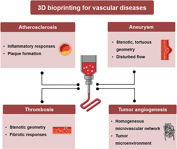 3D bioprinting technology for modeling vascular diseases and its ...
