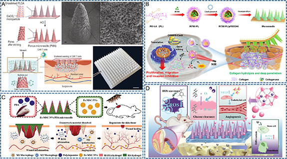 Review on engineered polymer microneedles for drug delivery and disease ...