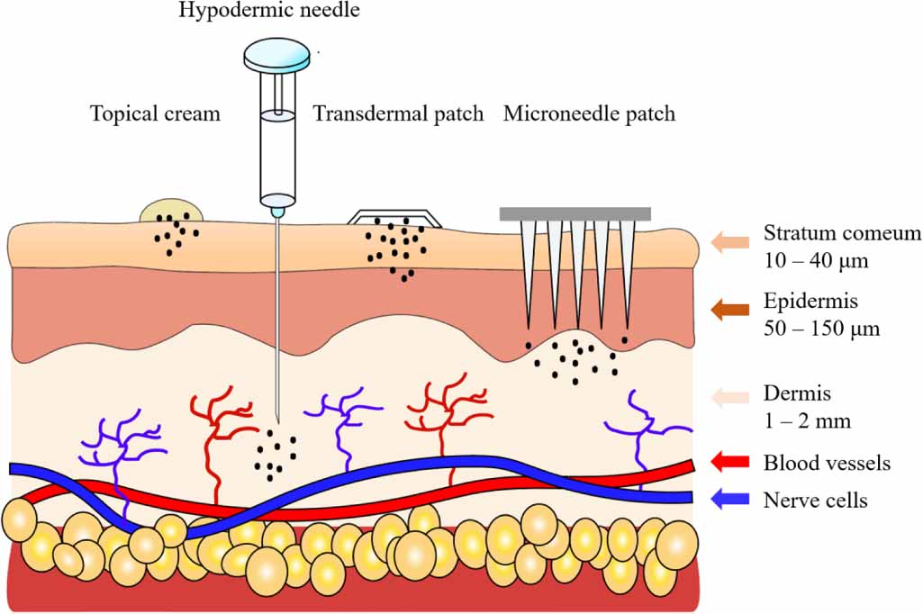 Review on engineered polymer microneedles for drug delivery and