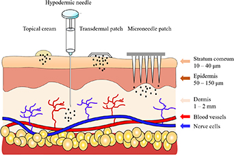Embedded Needle Review on engineered polymer microneedles for drug delivery and disease ...