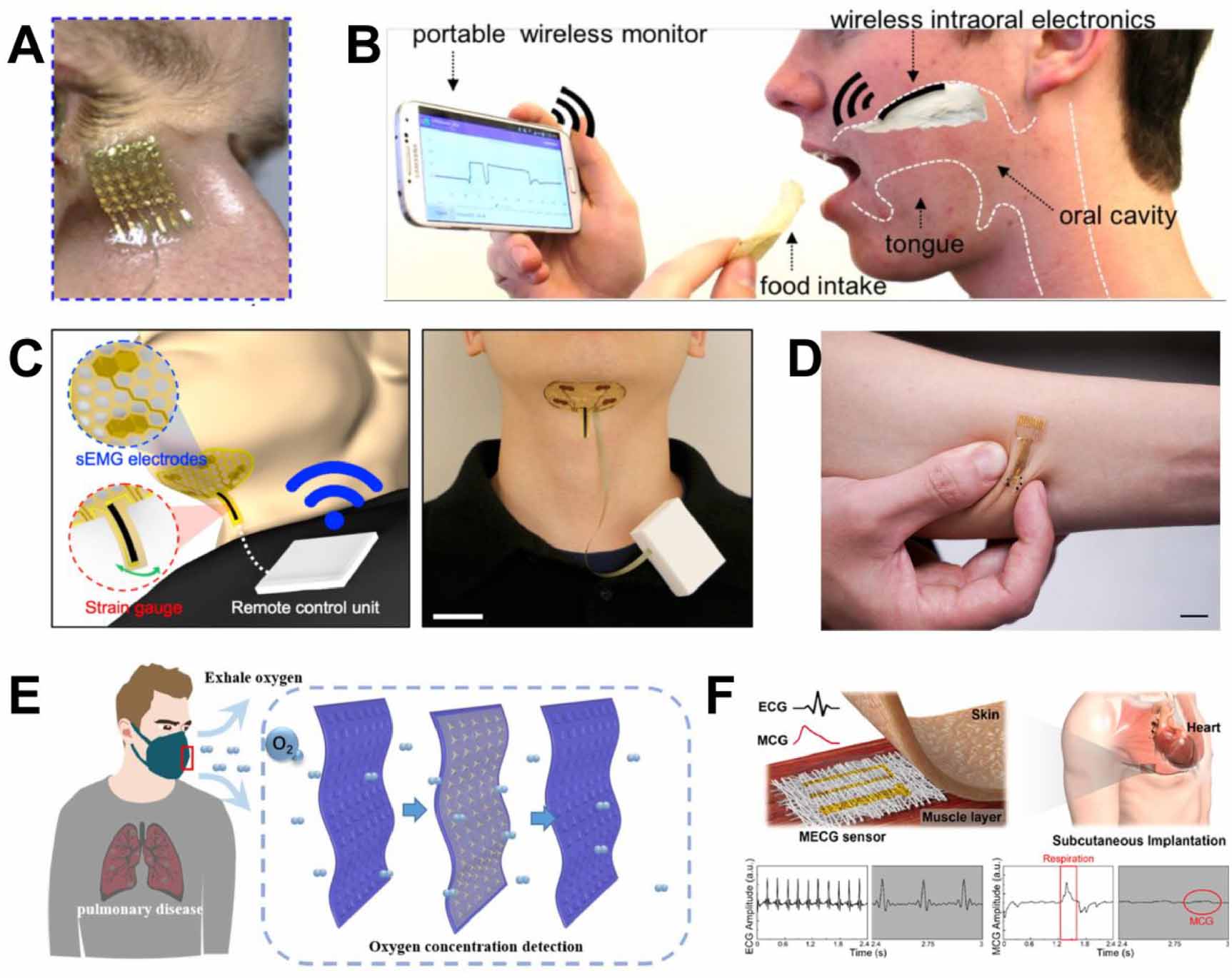 Genomics Example Device Genetically programmable wearable devices for precision physiological ...