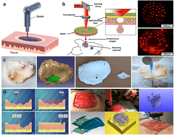 3D bioprinting in tissue engineering: current state-of-the-art and ...