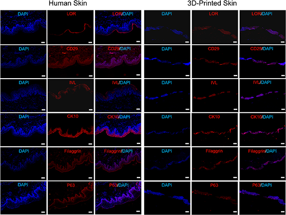 Construction of a 3D bioprinted skin model for psoriasis research and ...