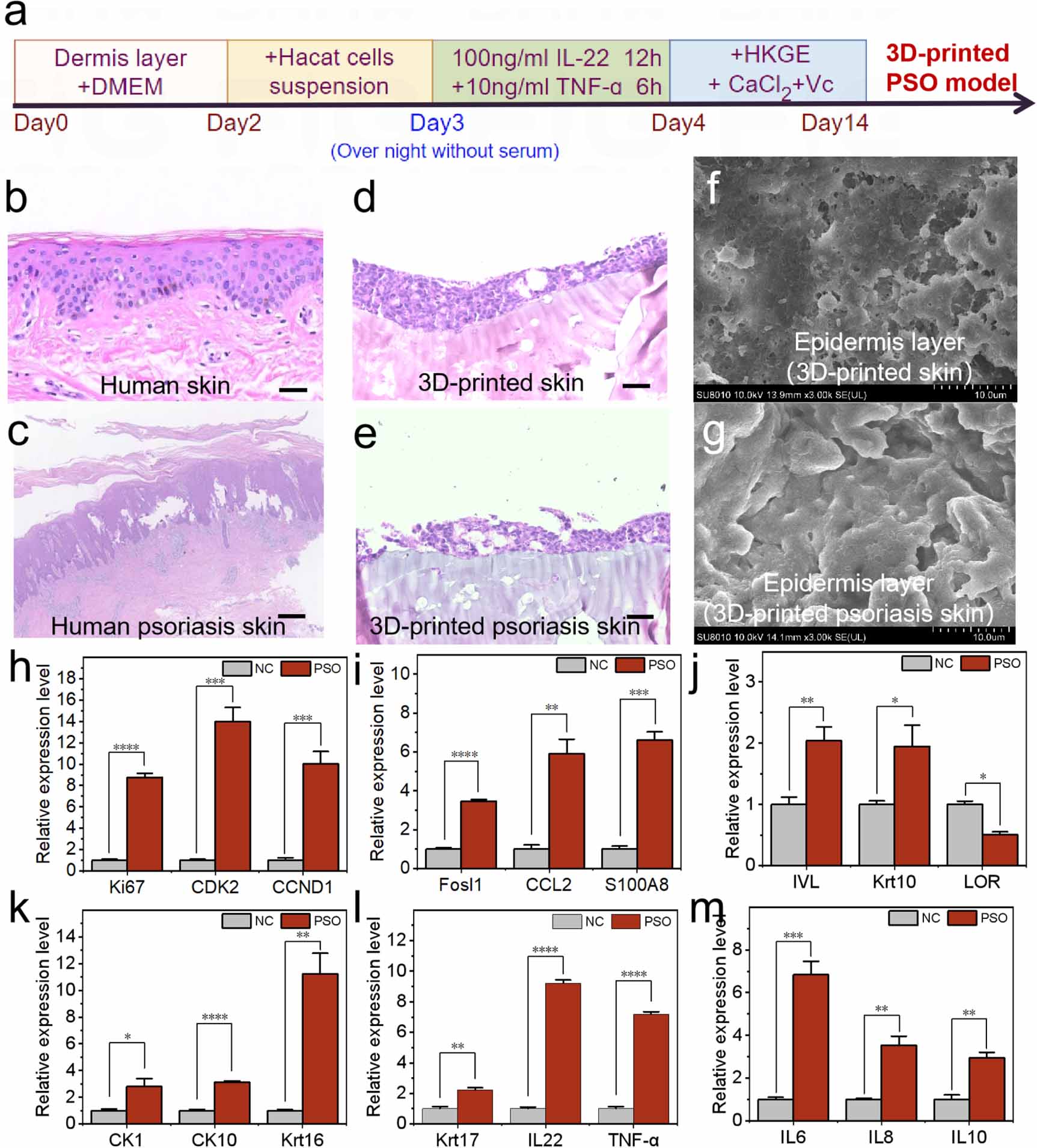Construction of a 3D bioprinted skin model for psoriasis research and ...