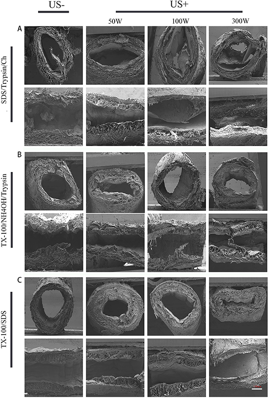Ultrasound-optimized decellularization and functional modification for ...