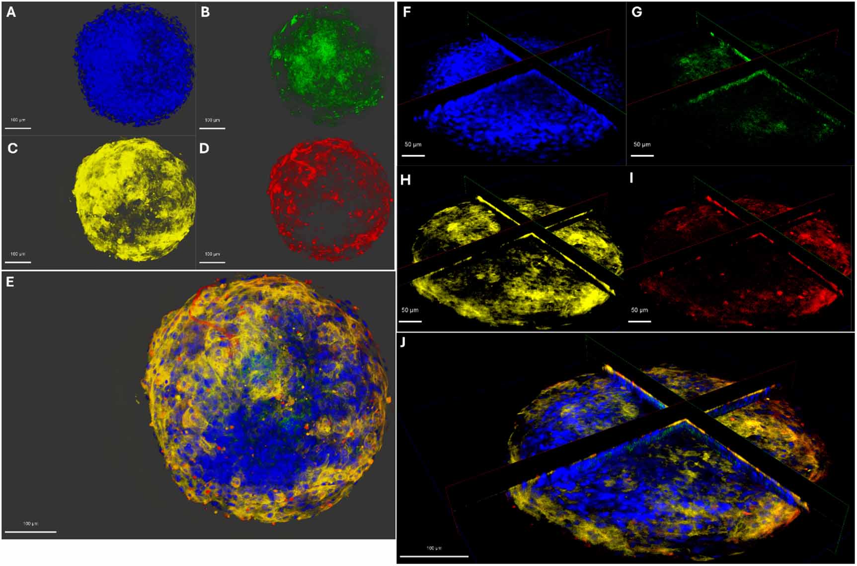 Exploding Spheroids Cardiac spheroids as a human model for inflammation induced cardiac ...