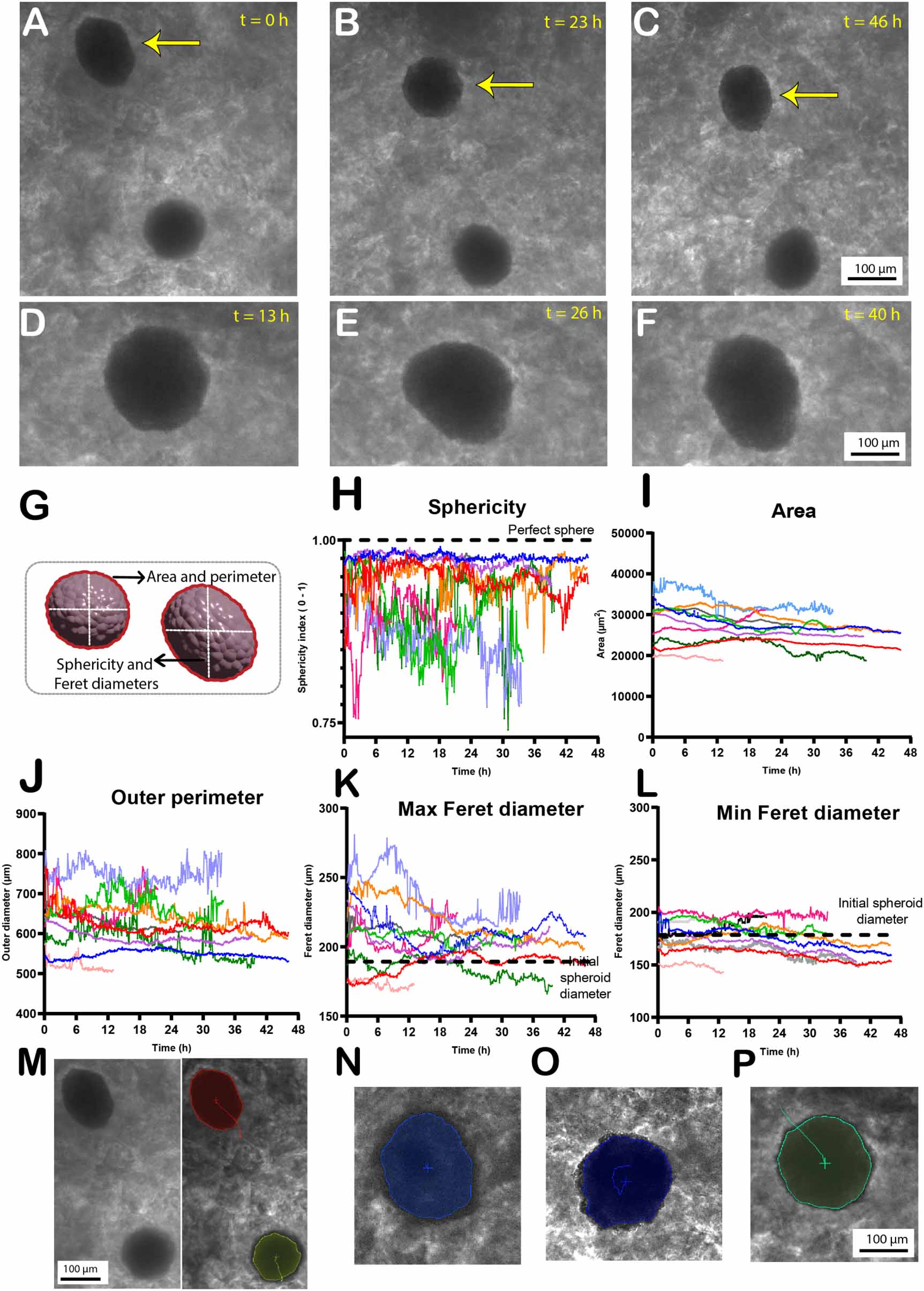 An automated pipeline for tracking and measuring cell spheroids ...