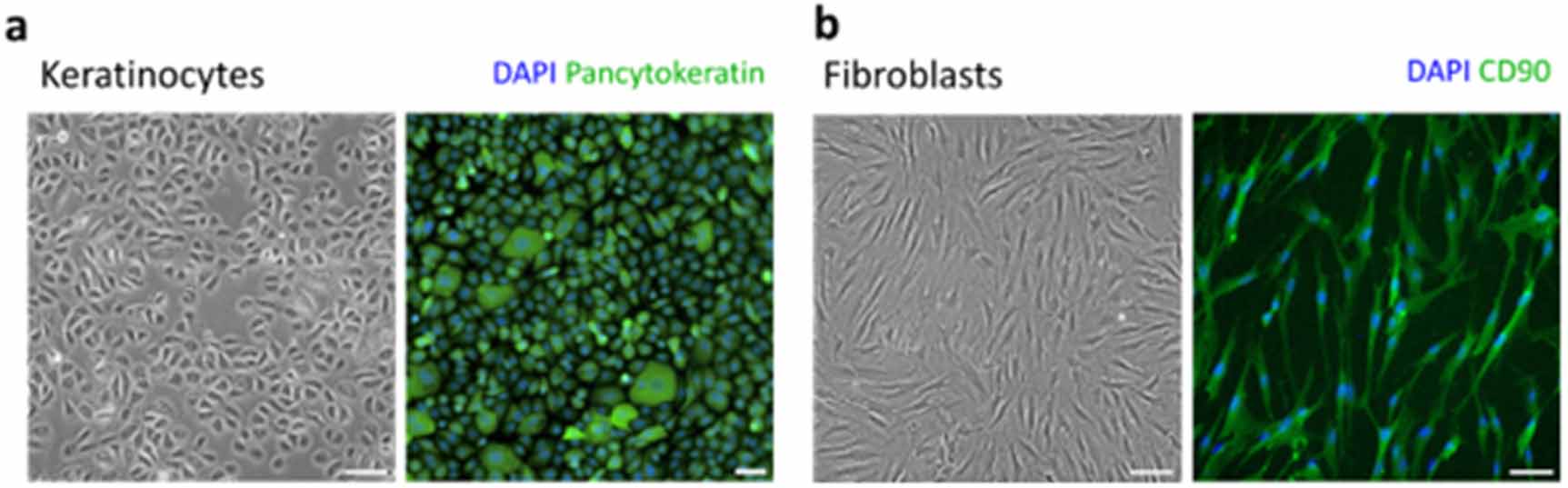 Radial constraint of plastically compressed human dermo-epidermal skin ...