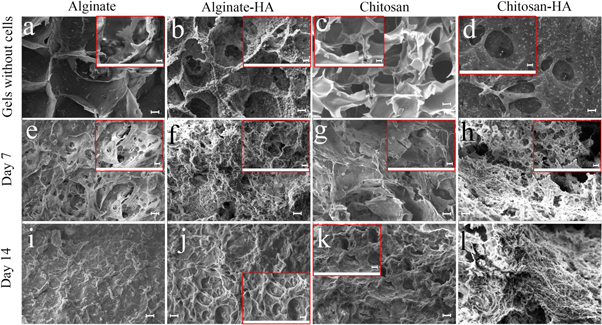 A bioprintable form of chitosan hydrogel for bone tissue engineering ...